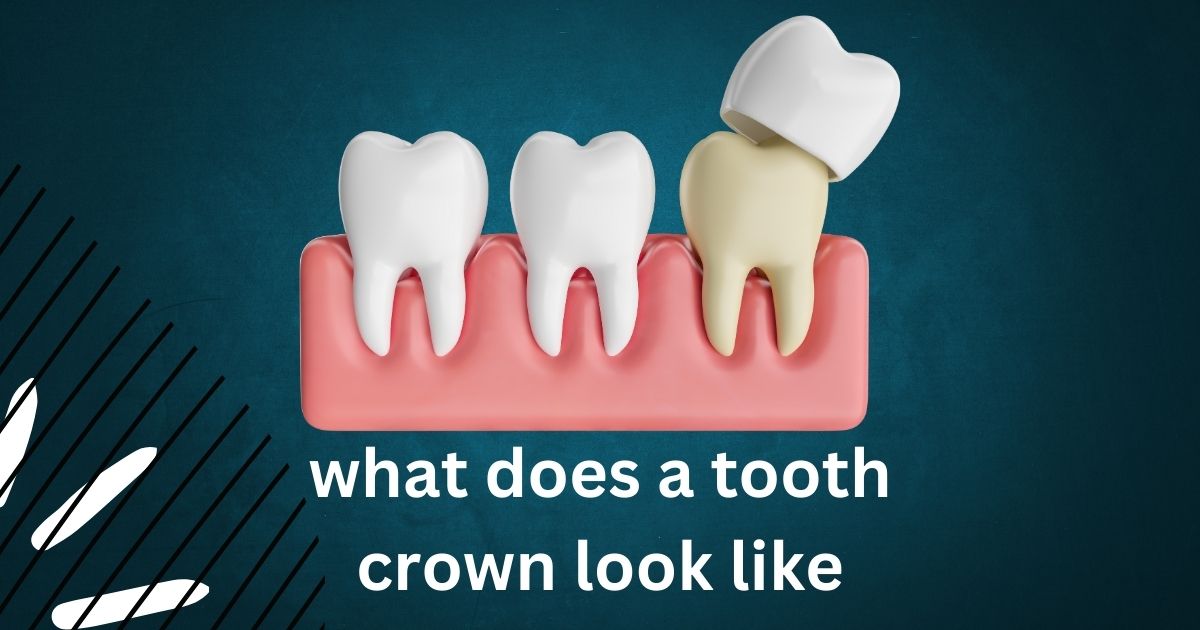 what does a tooth crown look like​