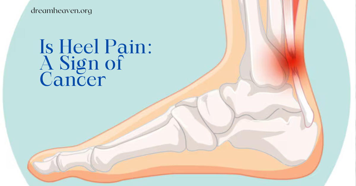 Is Heel Pain: A Sign of Cancer